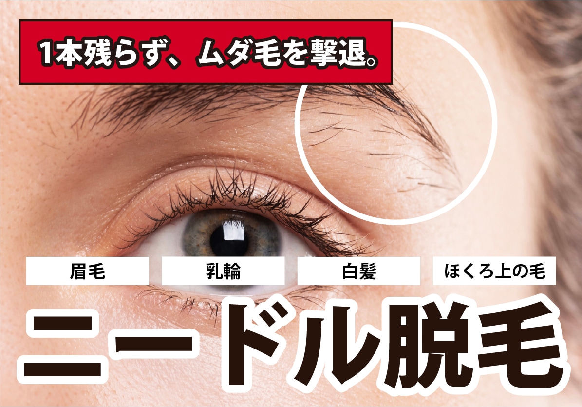 ＼✨new✨／ ニードル脱毛（医療針脱毛／絶縁針脱毛）取り扱い開始‼️【大阪梅田本院】