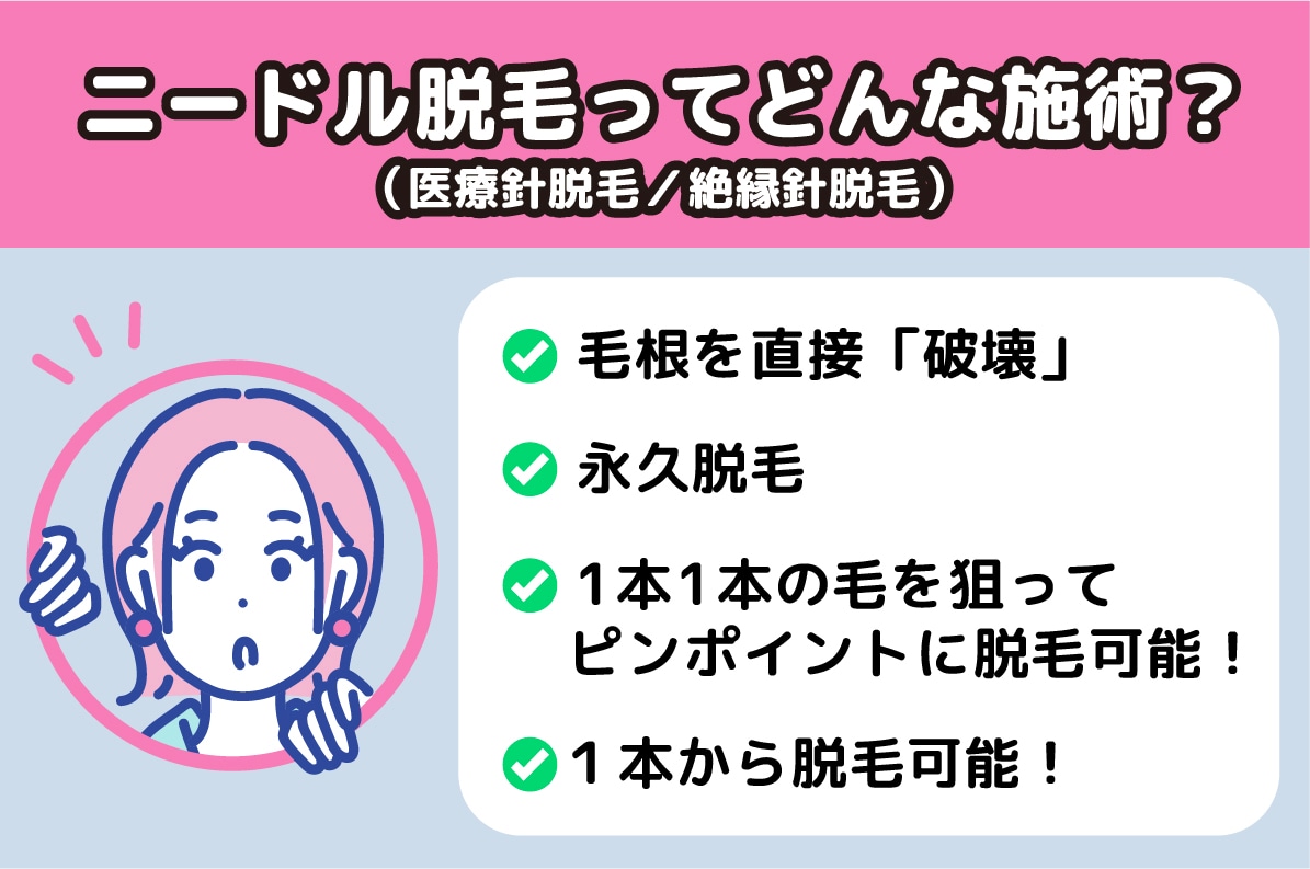 ニードル脱毛の特徴