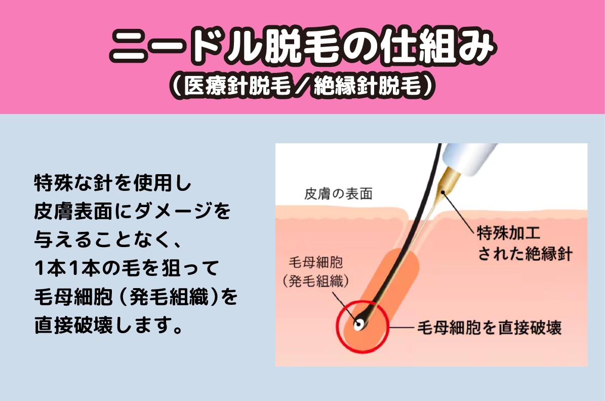毛を“1本1本”狙い撃ち🔫💥‼️