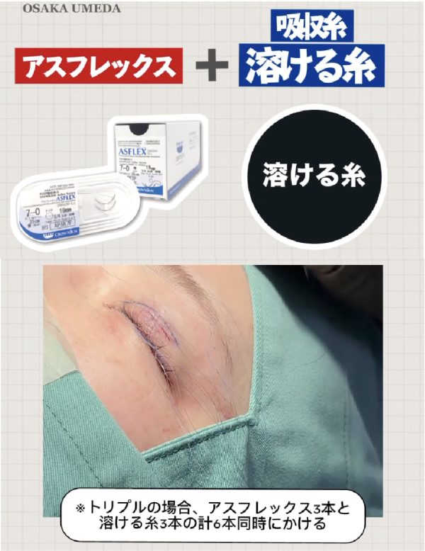 自分の組織が「天然のギプス」になる