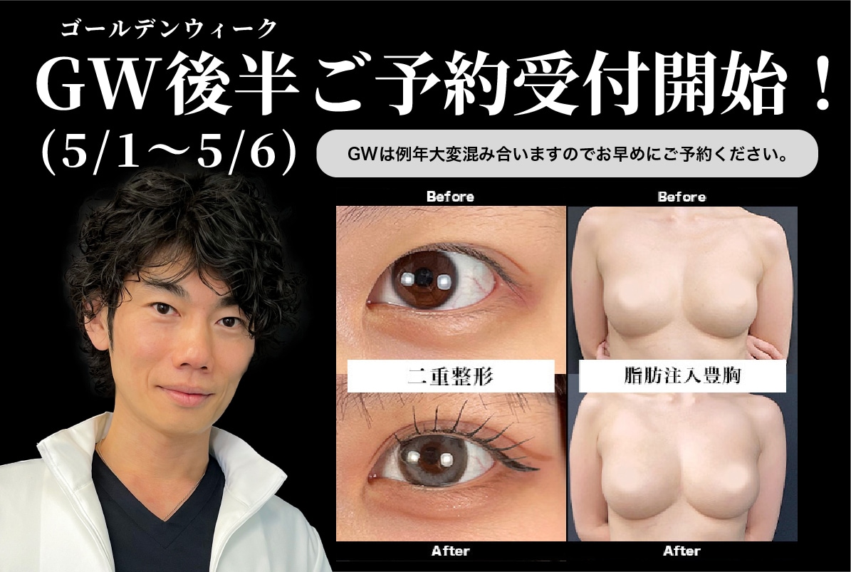 【⚠️最速情報⚠️】GW (5/1〜5/6)ご予約受付開始‼️