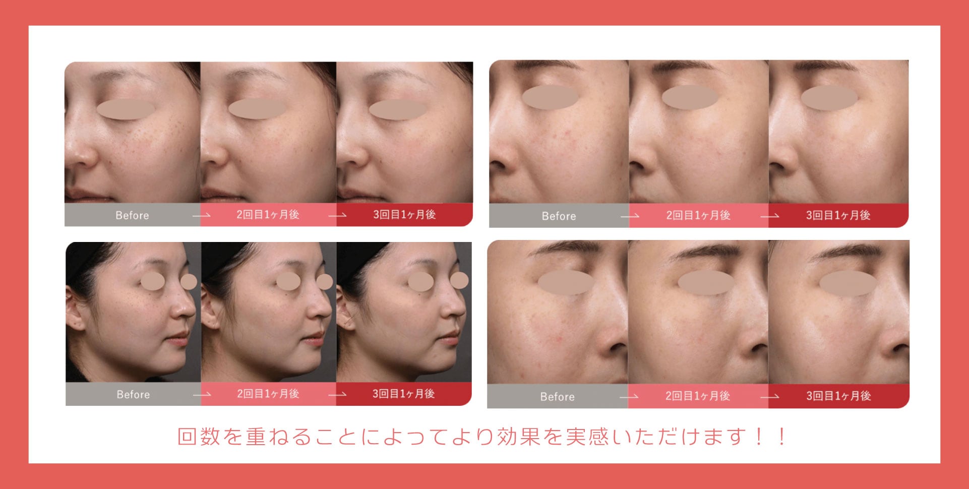 3回コースがオススメです❤️