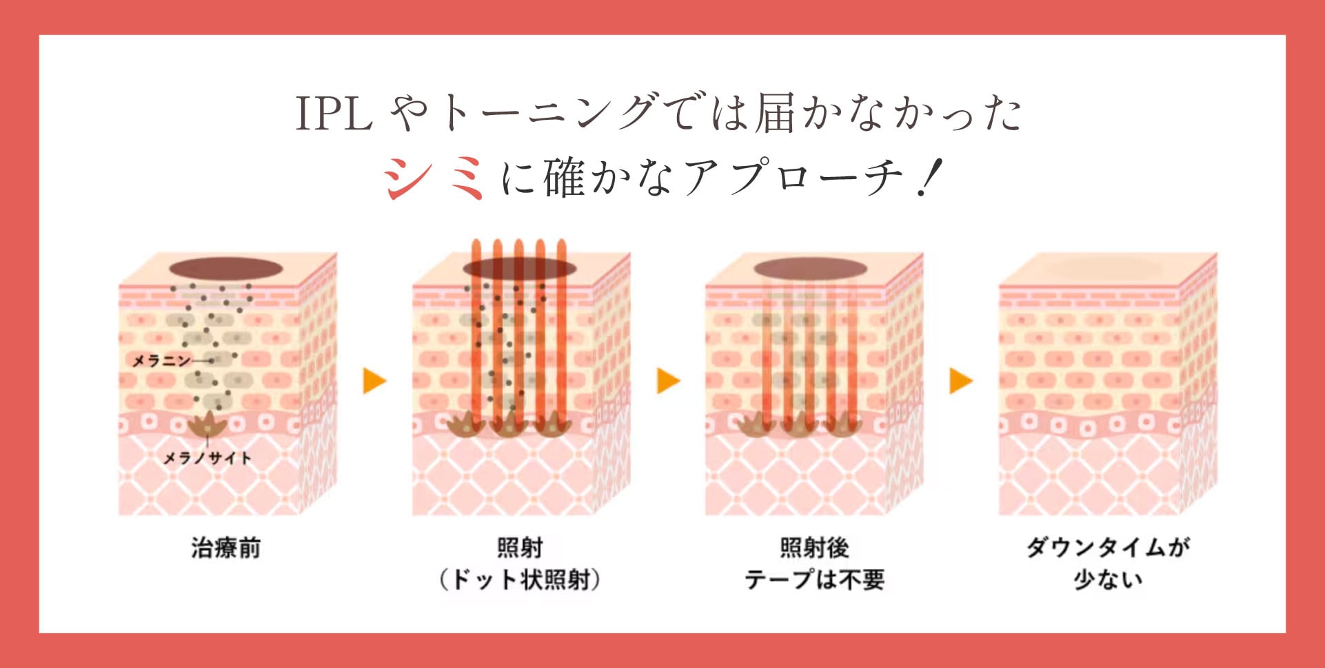 幅広いシミに適応のシミの新治療✨