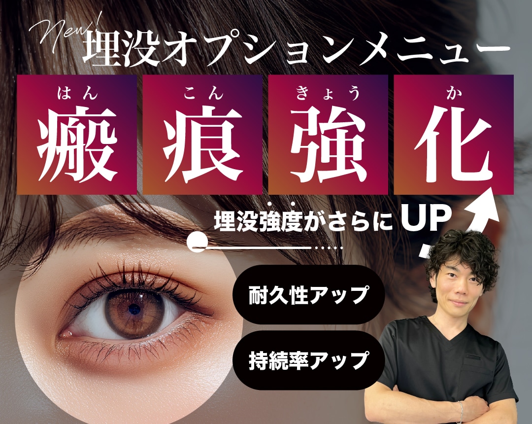 【埋没もう取れたくない方へ】埋没の強度を強化するオプションメニュー新登場！二重埋没整形するならSBC大阪梅田本院・横谷医師にお任せ