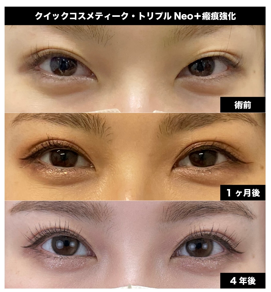 数年経っても美しいラインが保たれる