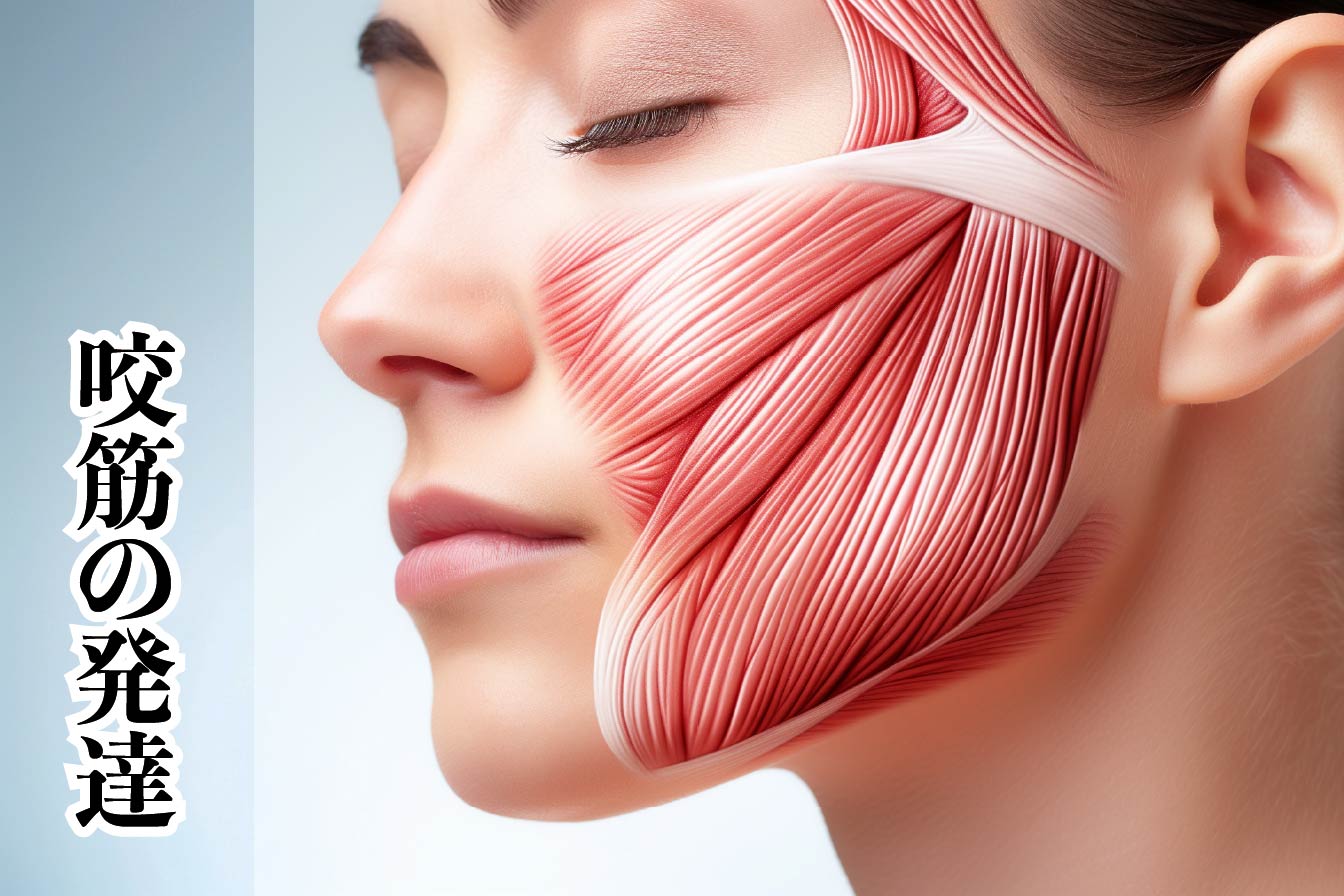 エラ張りの原因は「筋肉」の発達