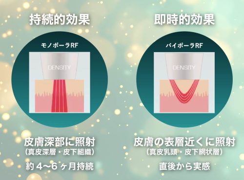 「たるみ改善」と「肌質改善」を同時に叶える最新リフトアップ治療