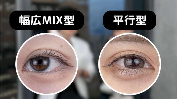 ラインの自由度