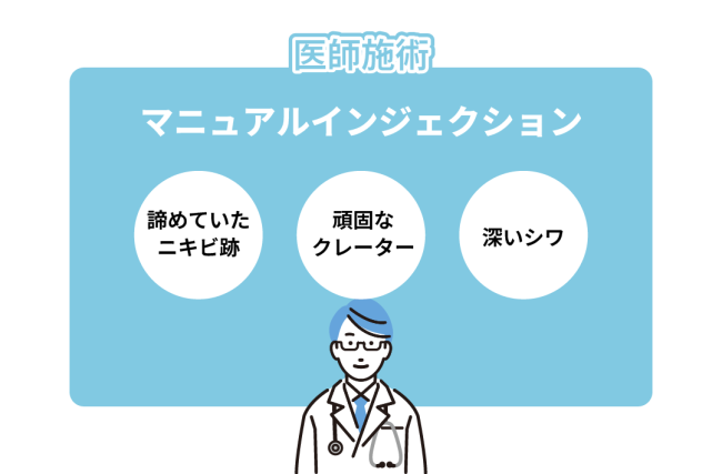 機械任せにしない！【医師施術】だから変わる理由