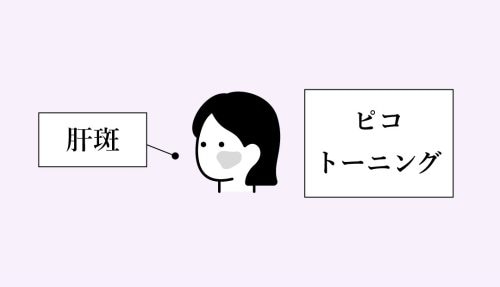 お悩み：肝斑