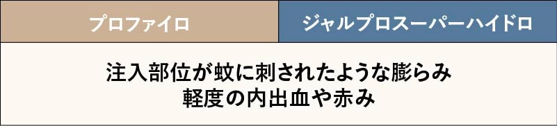 ダウンタイムはありますか？