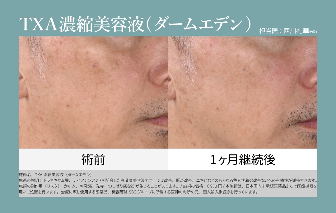 お家で美白治療🌟