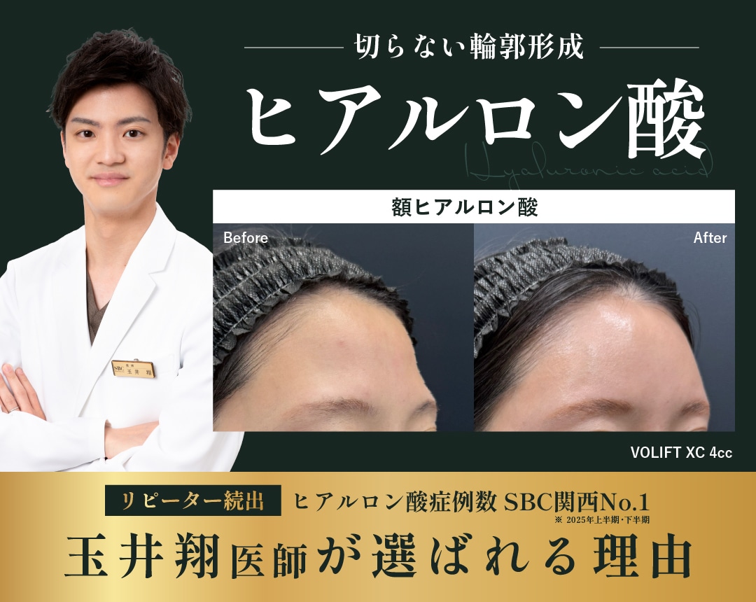 【ヒアルロン酸】大阪梅田でヒアルロン酸なら玉井翔医師にお任せ