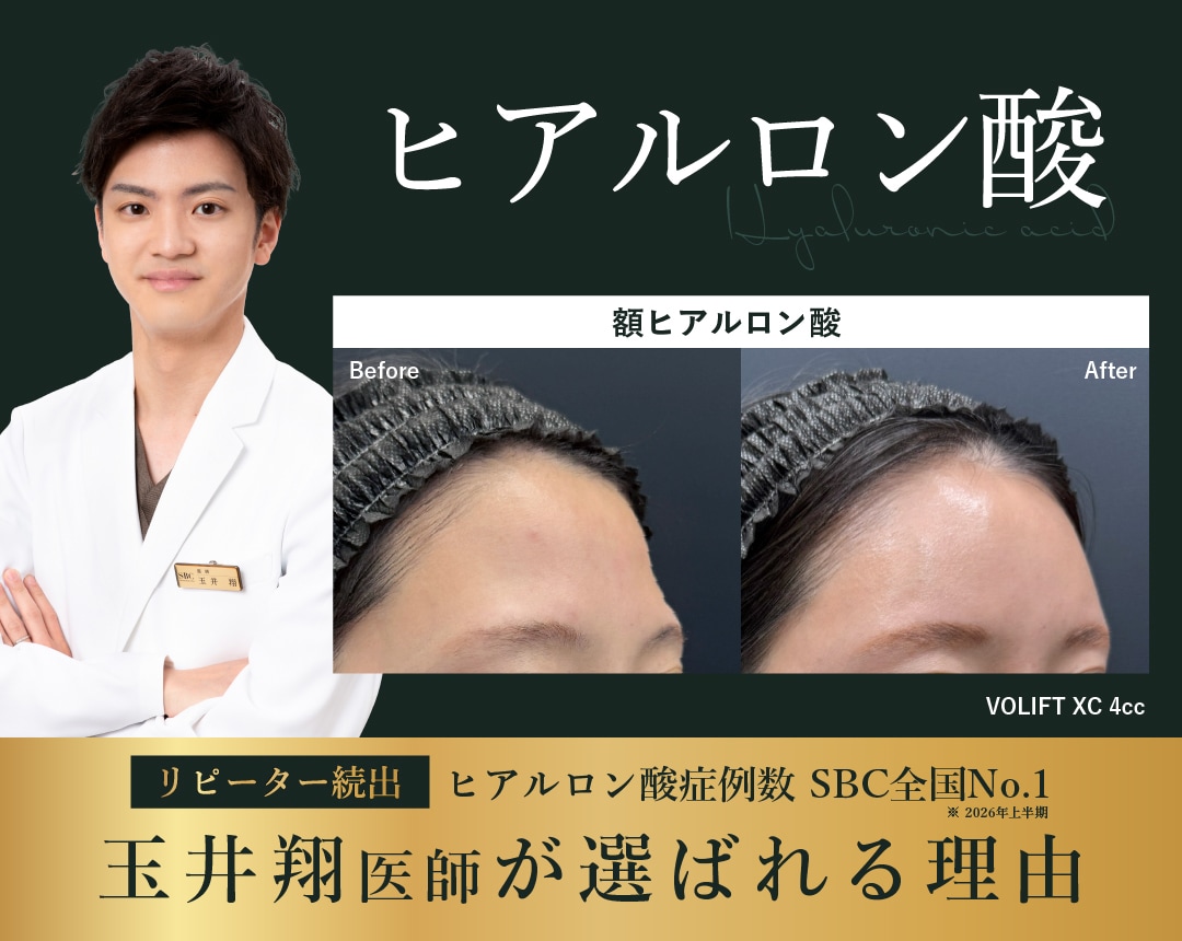【ヒアルロン酸】大阪梅田でヒアルロン酸なら玉井翔医師にお任せ