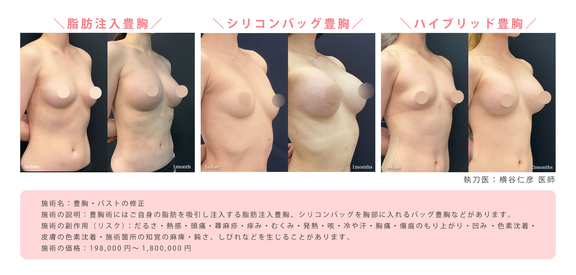 大人気！豊胸プレミアムドクターの豊胸術✨