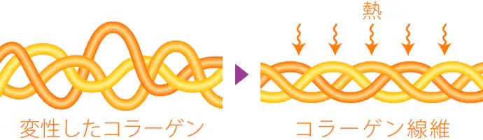 ポイント① 引き締め効果とフェイスライン改善効果