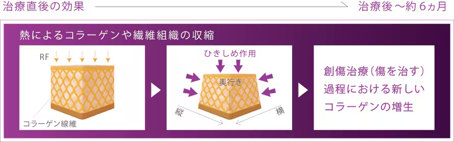ポイント② 長期的なコラーゲンの再構築