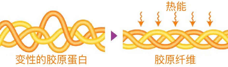 亮点① 紧致效果与下颌线改善效果