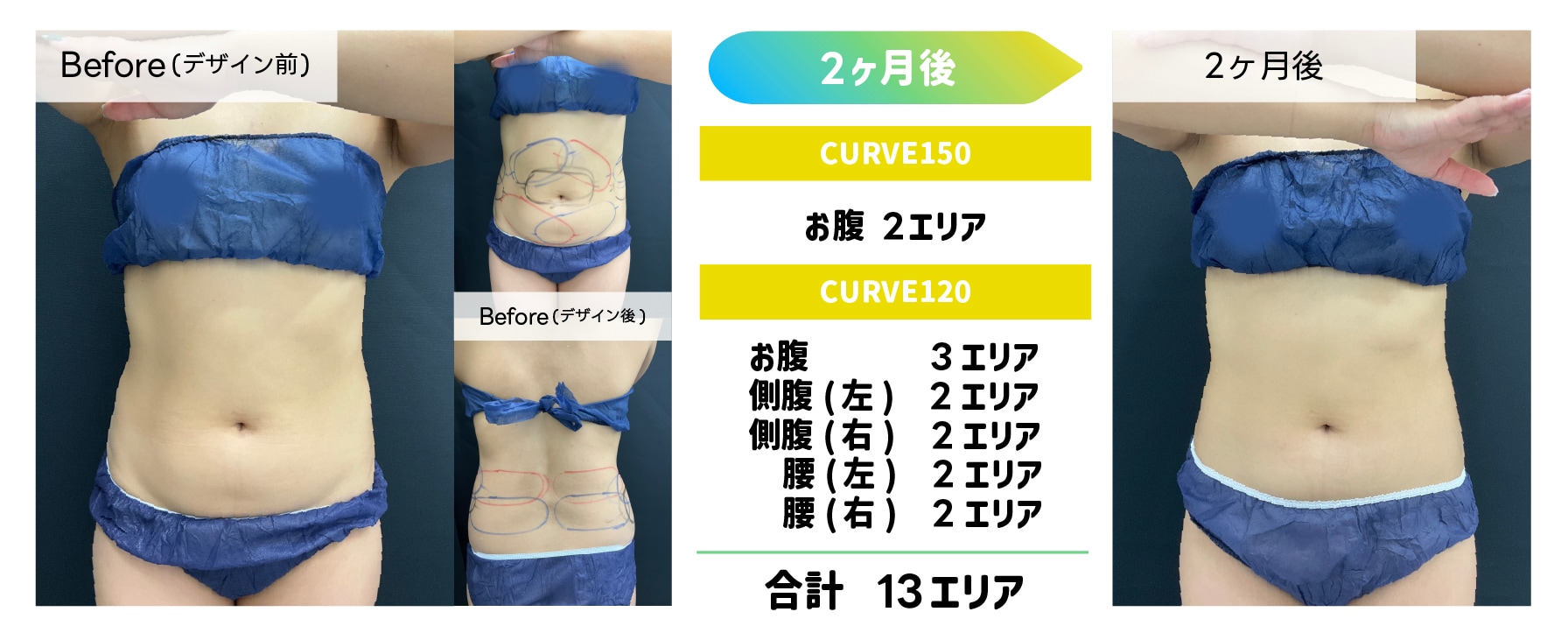 まずは症例をご覧ください＾＾