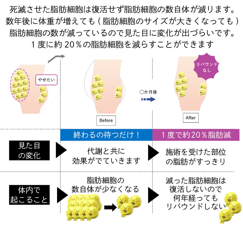 医療痩身の体重減少の仕組みは？
