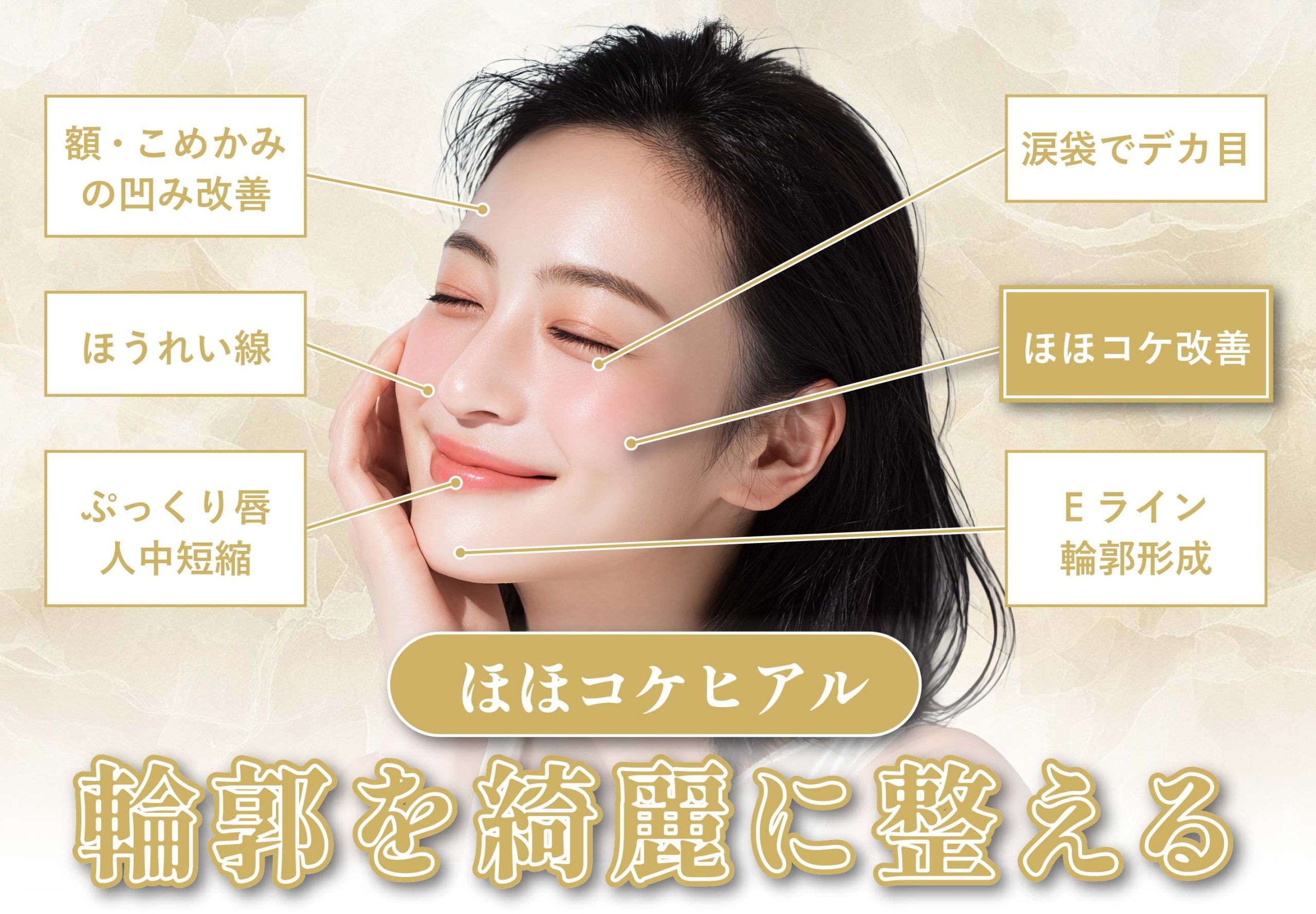 ほほコケ