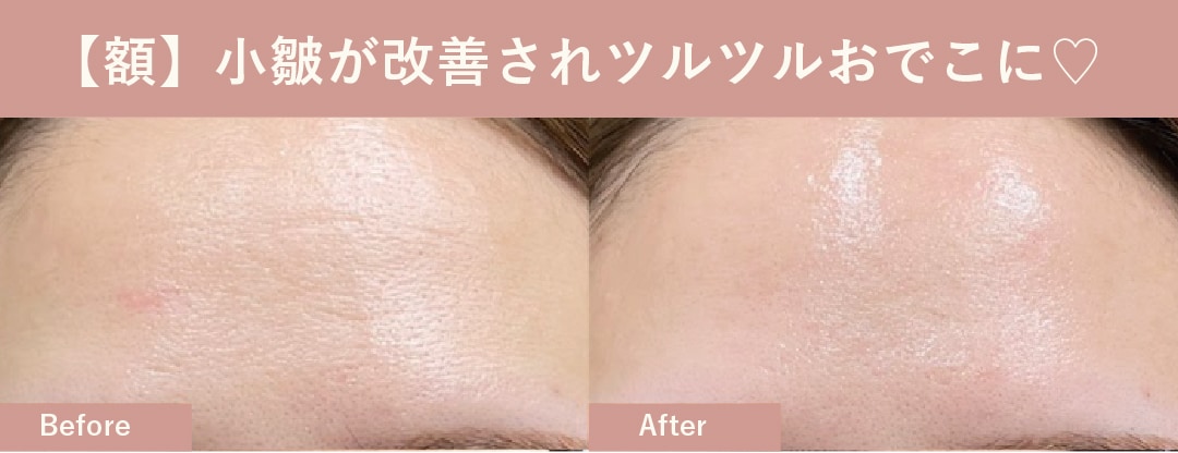 見たらやりたくなる♡症例写真をご覧ください！