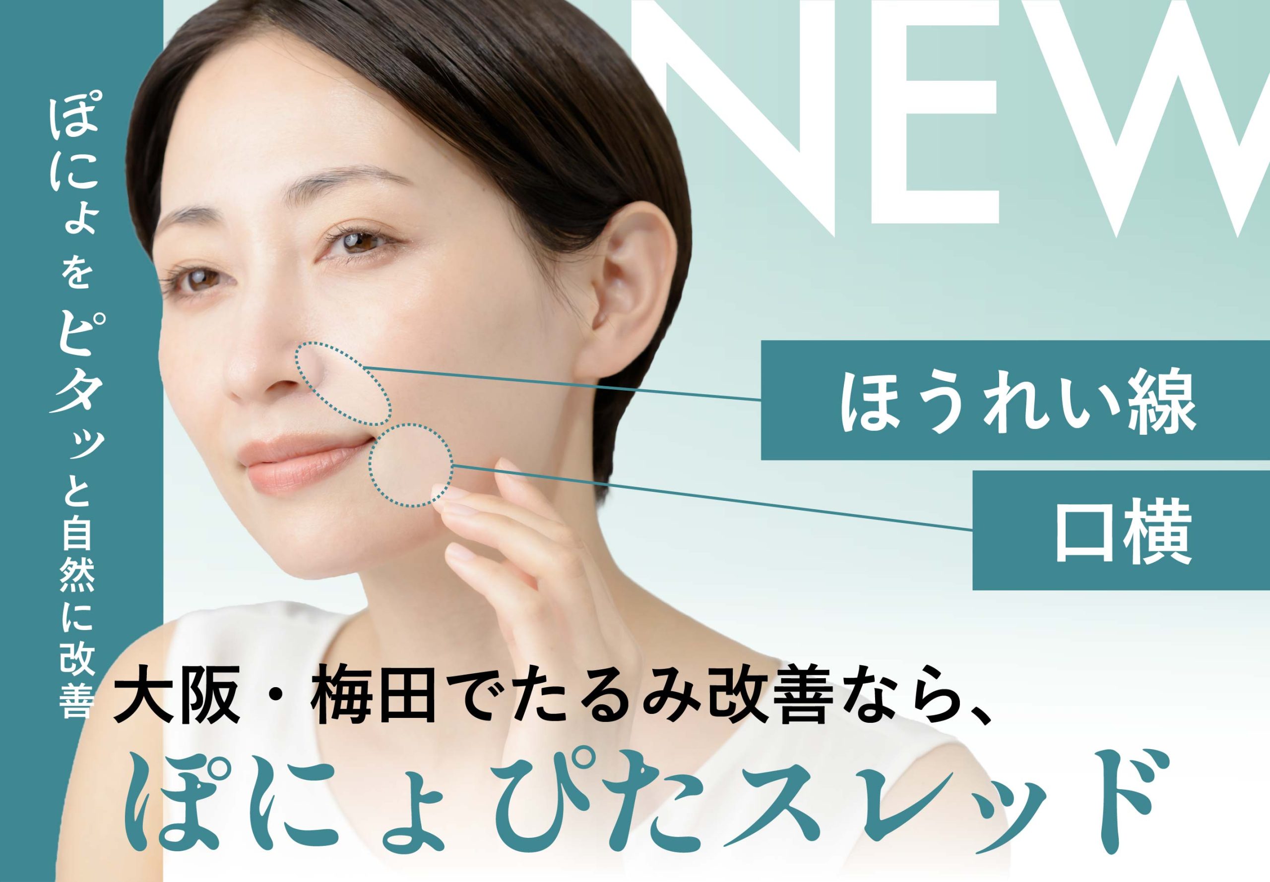 大阪・梅田でたるみ治療なら｜【新治療】ぽにょぴたスレッドが湘南美容クリニック大阪梅田本院に新登場