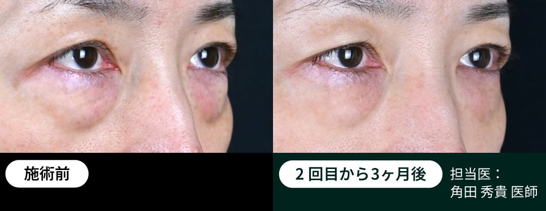 解剖学に基づいた「オーダーメイド照射」