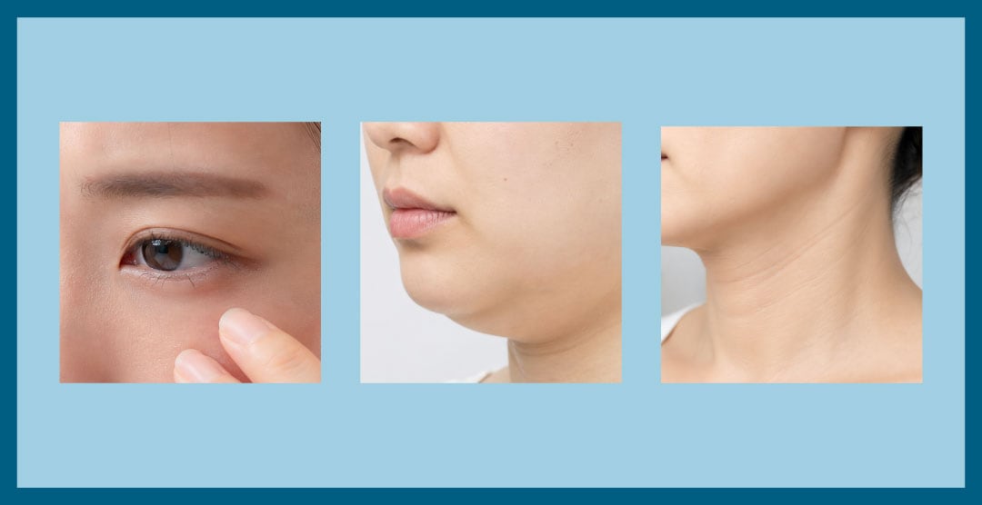 目元・あご下・首元までトータルケアが可能