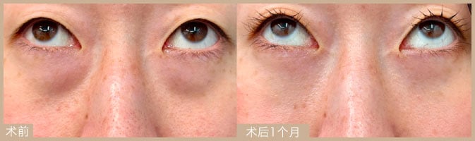 能够塑造平缓的面颊线条