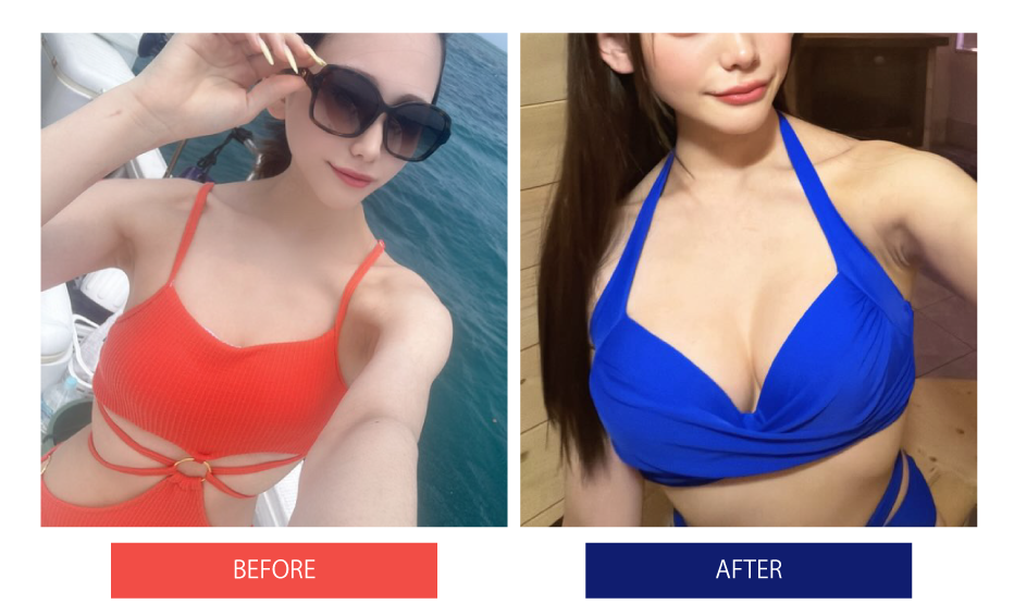 ※お客様にいただいたプライベート写真の比較