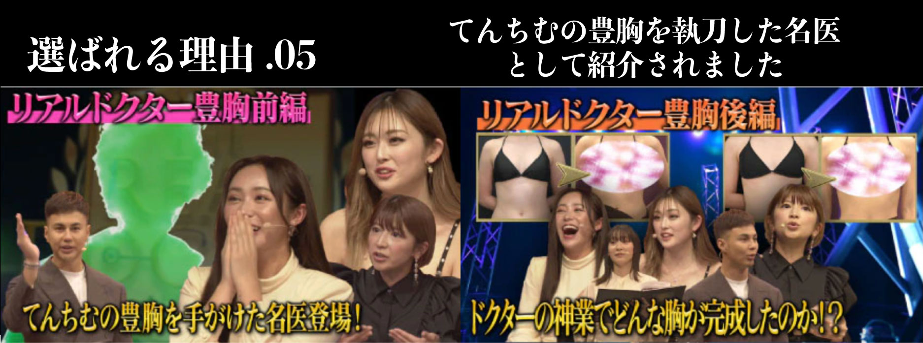 てんちむの豊胸を執刀した名医として紹介されました