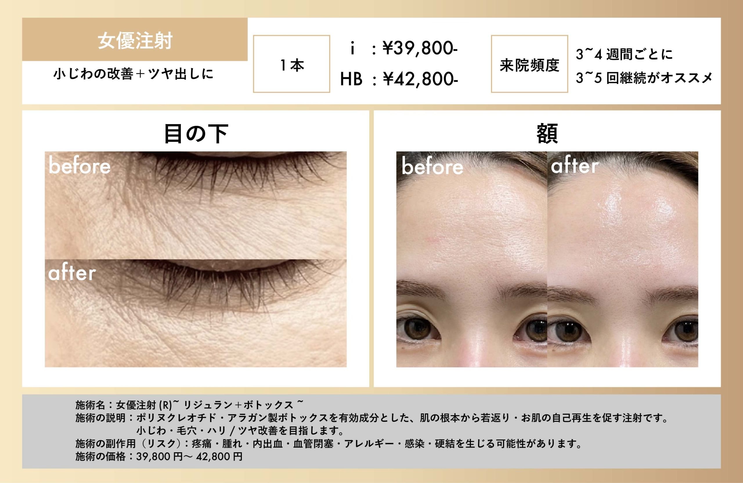 保湿では改善しない刻まれた小じわ