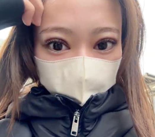 【術後2日目】