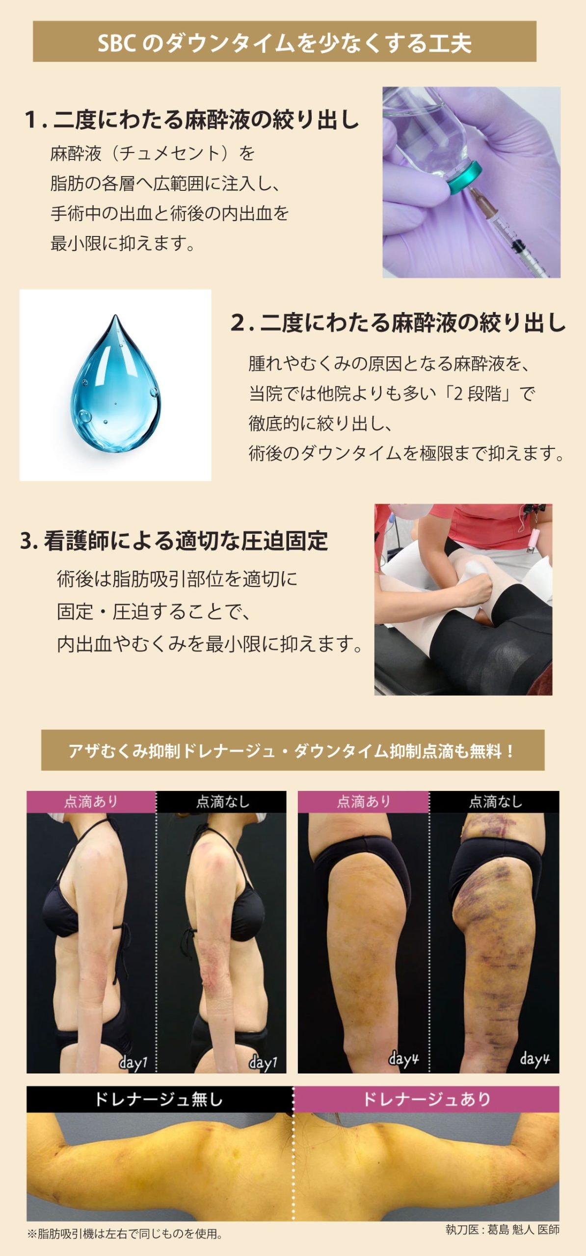 すべて無料】SBC独自の徹底したダウンタイム軽減ケア