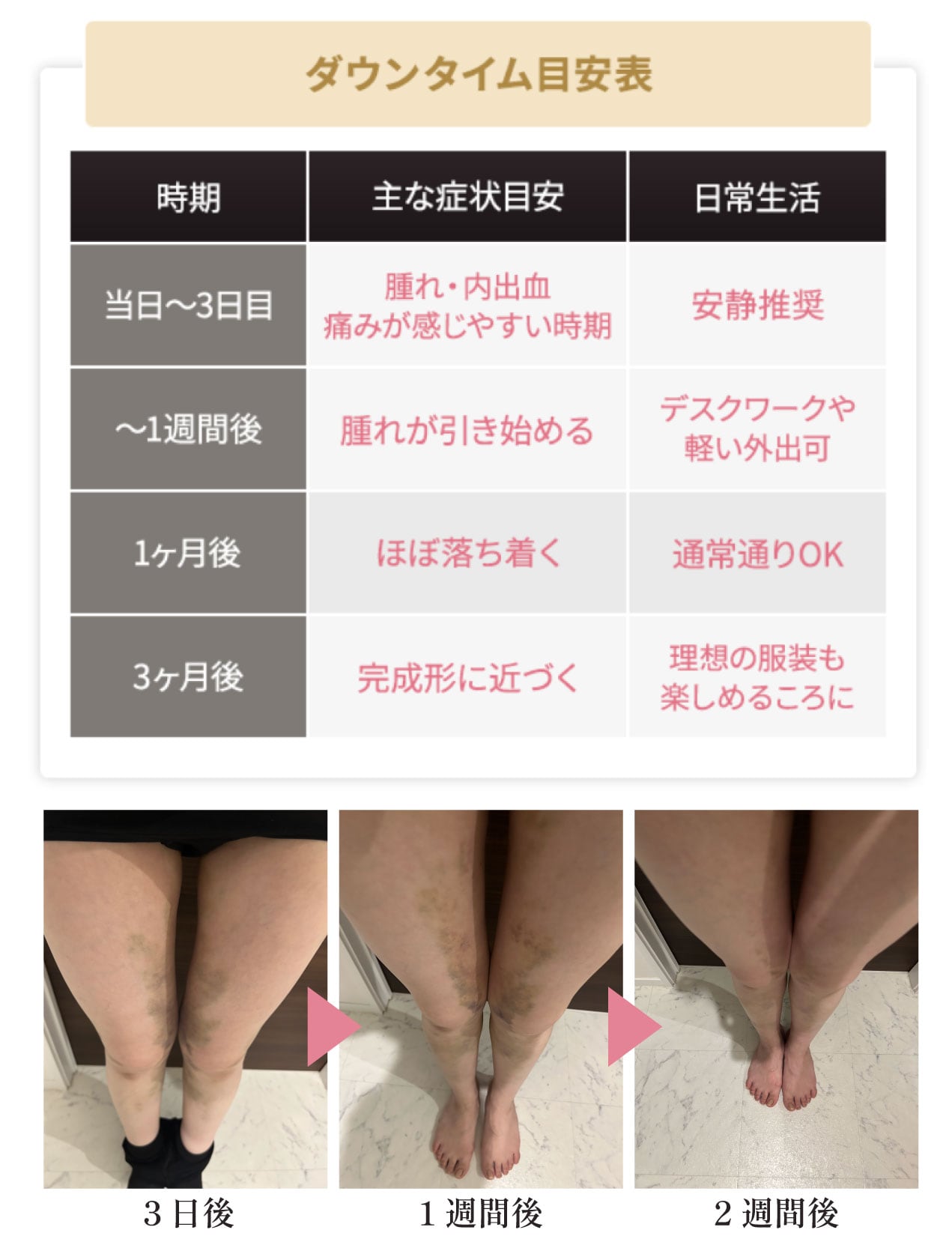 Q. ダウンタイムはどのくらいの期間ですか？日常生活への影響は？<br />
