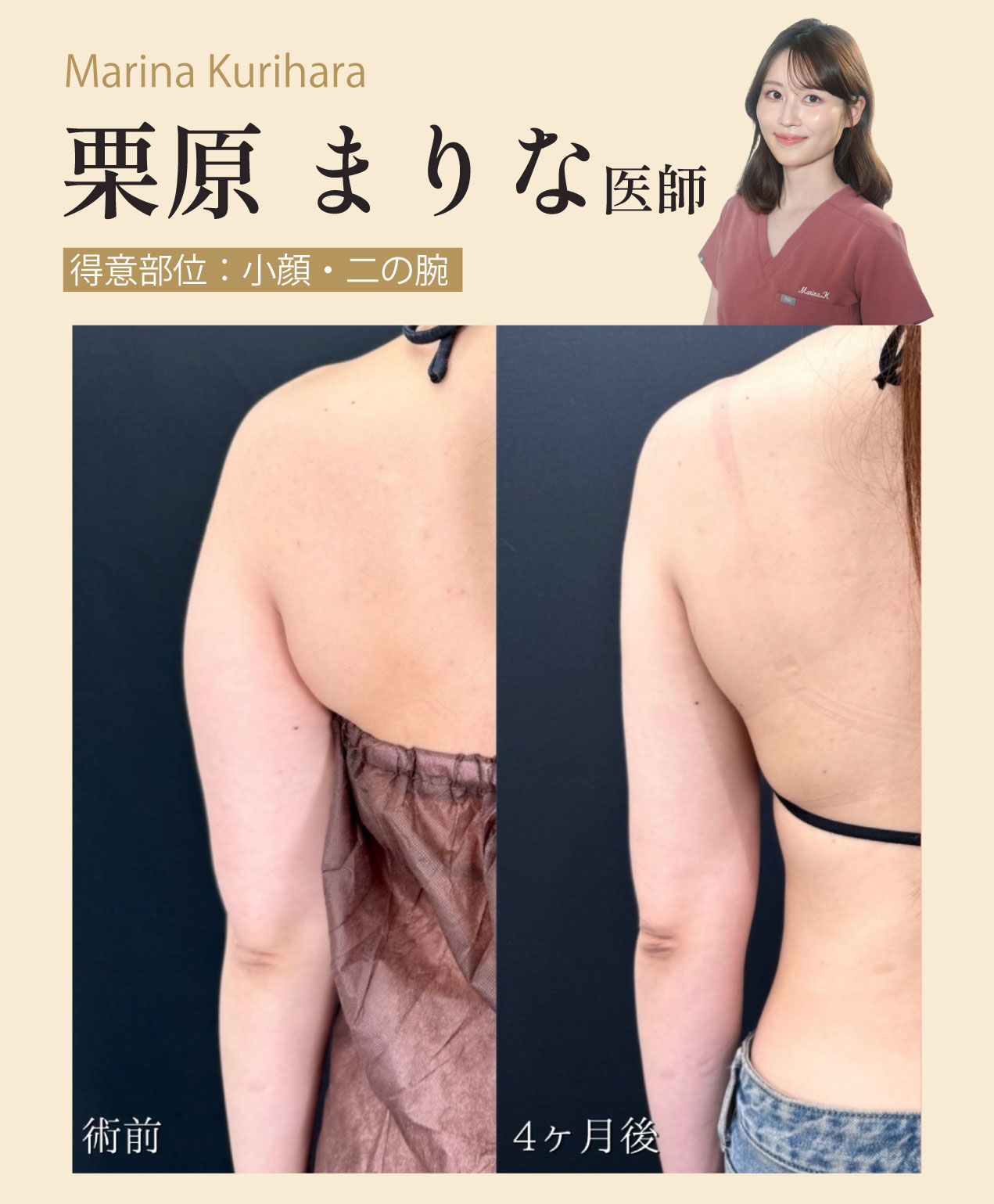 【女医】360°どこから見ても美しいナチュラルなアップデートは栗原医師 へ<br />
