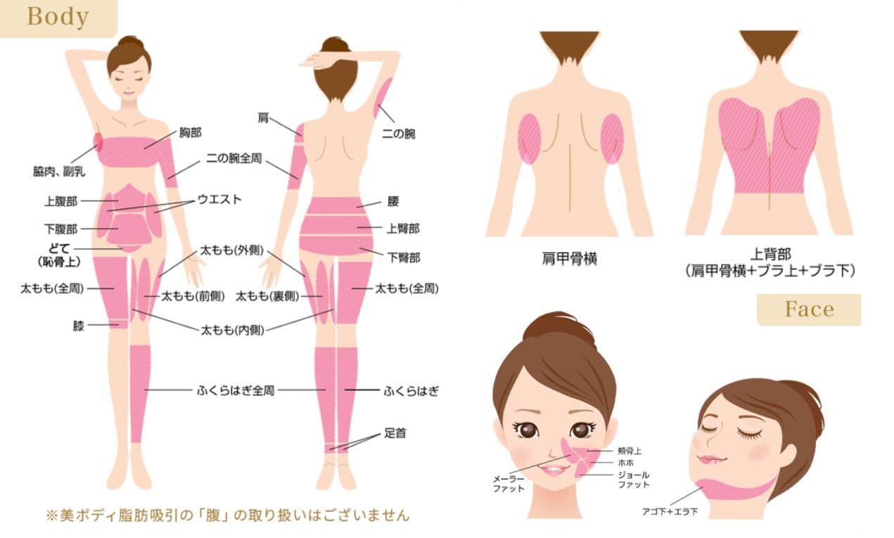 脂肪吸引の対応部位について