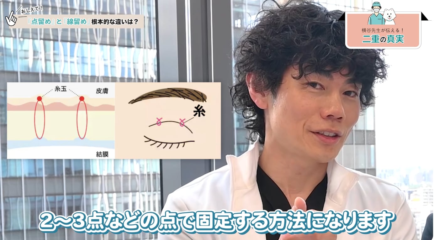 点留め