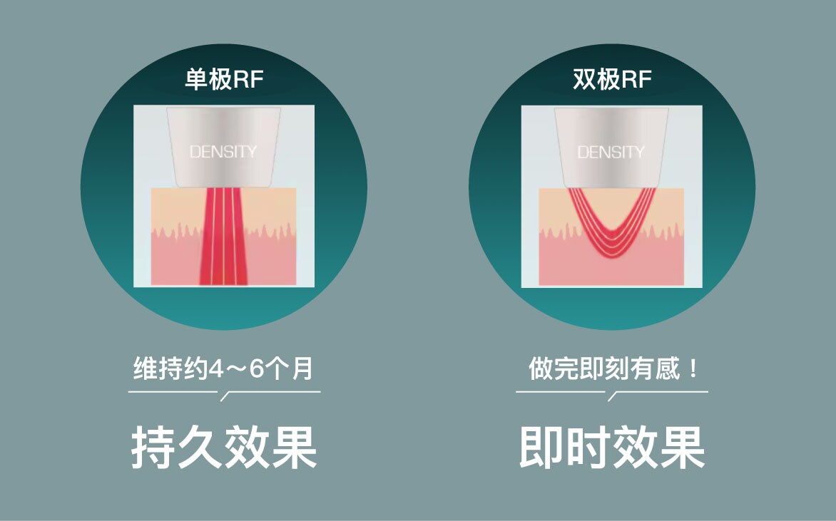 同时实现“改善松弛”与“改善肤质”的最新提拉抗衰治疗✨
