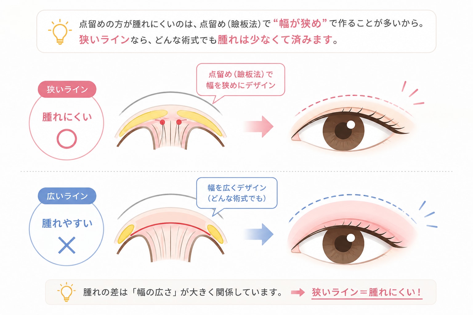 「点留め」の腫れは？