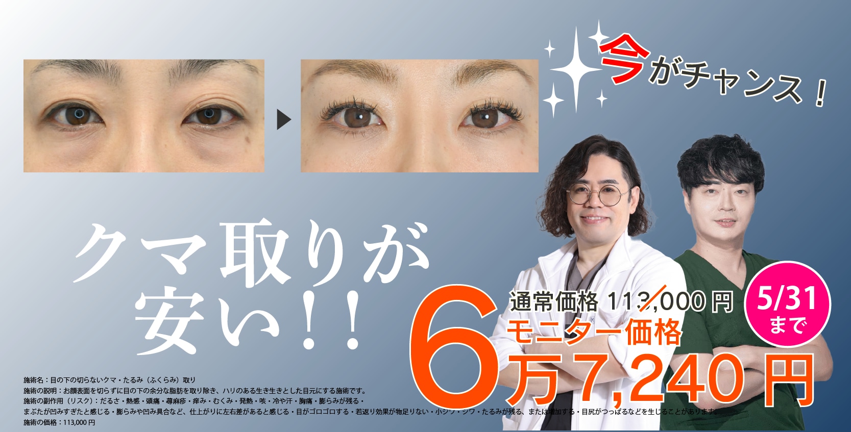 目の下のクマ・たるみで悩んでいる方は見逃さないで！