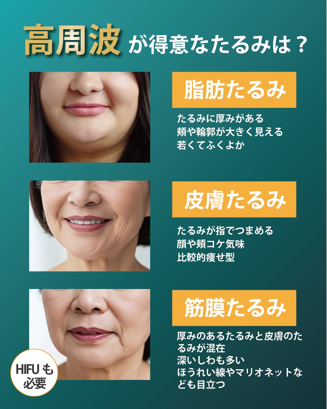 どんな人が向いているの？