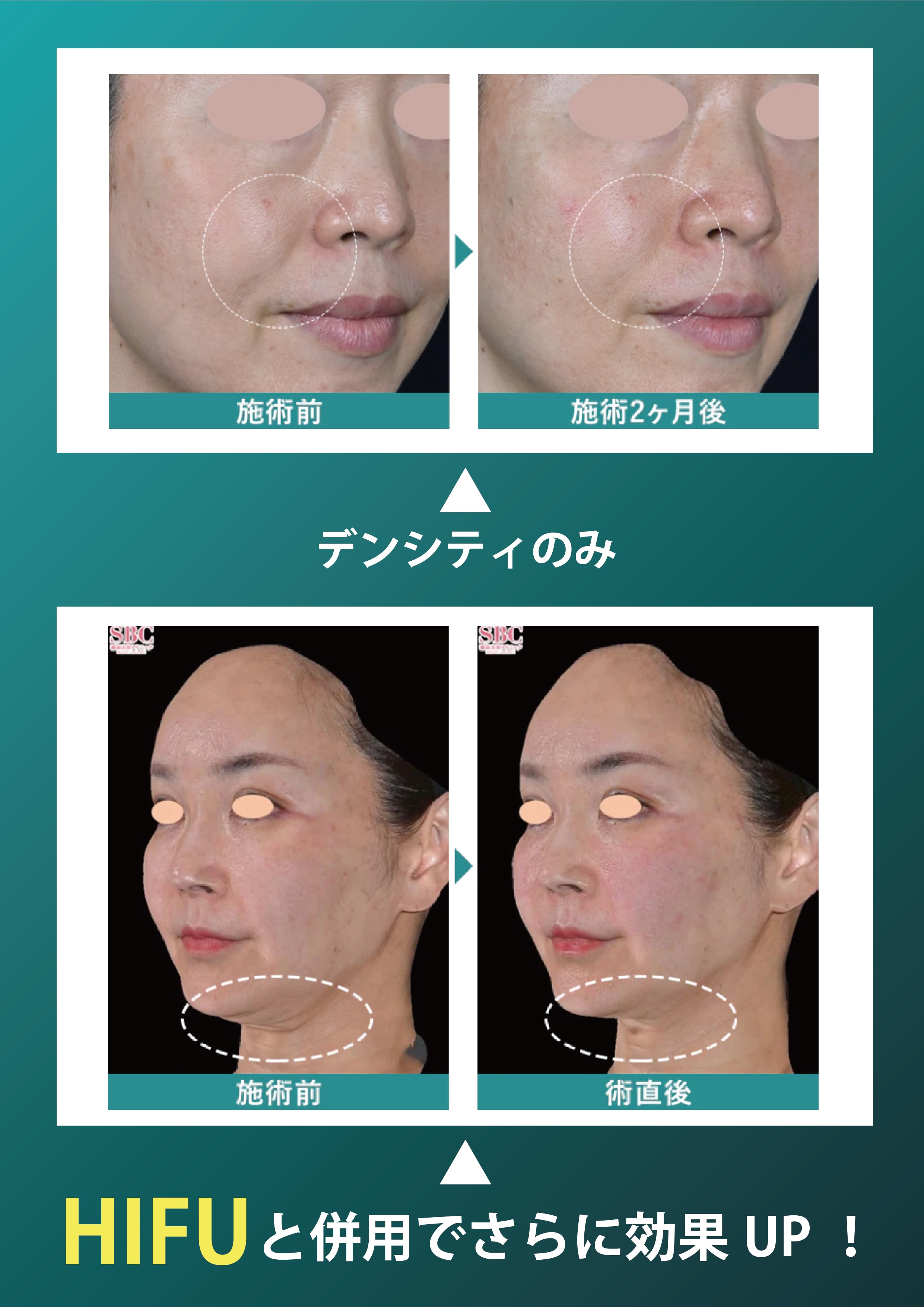 一緒に受けたい施術は？