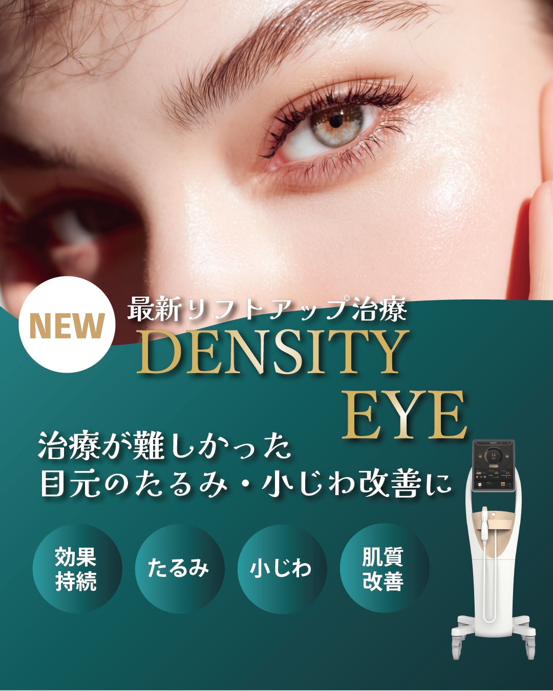 大阪京橋院でも「デンシティアイ」受けていただけます！