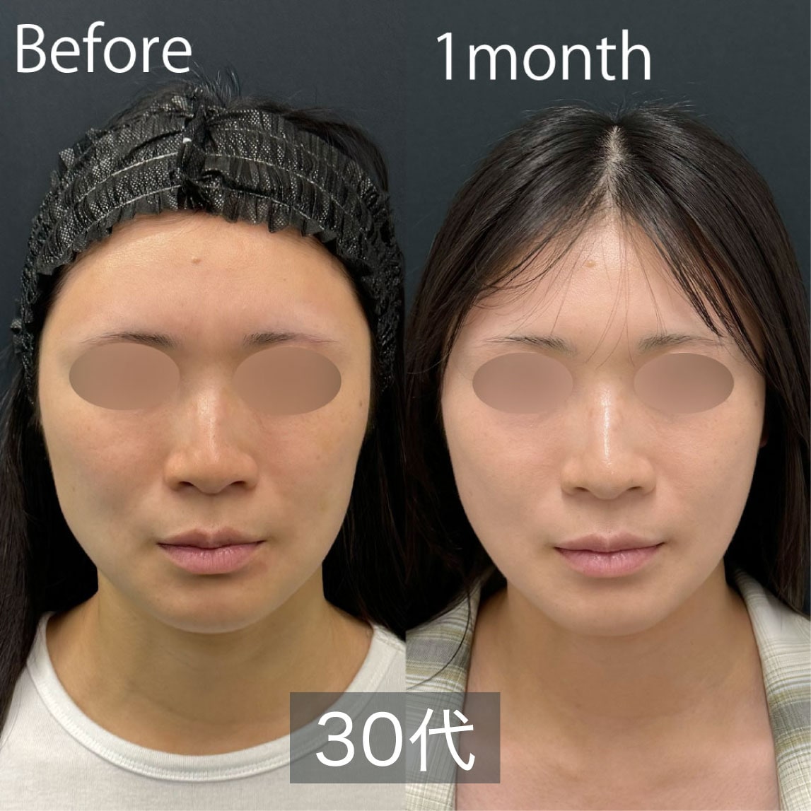 30代女性の症例