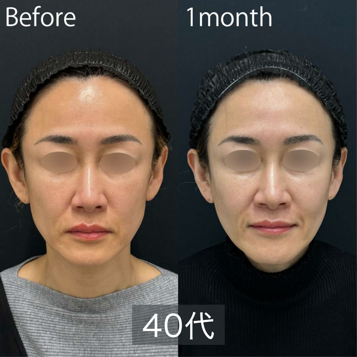 40代女性の症例