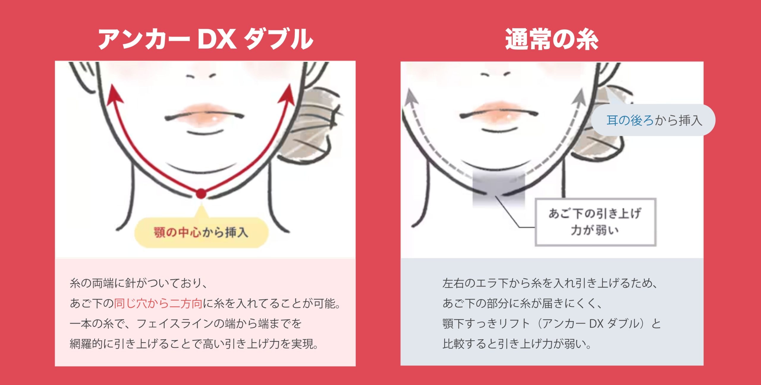 従来の糸とはどう違うの？🪡