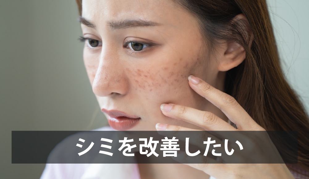 シミを改善したい