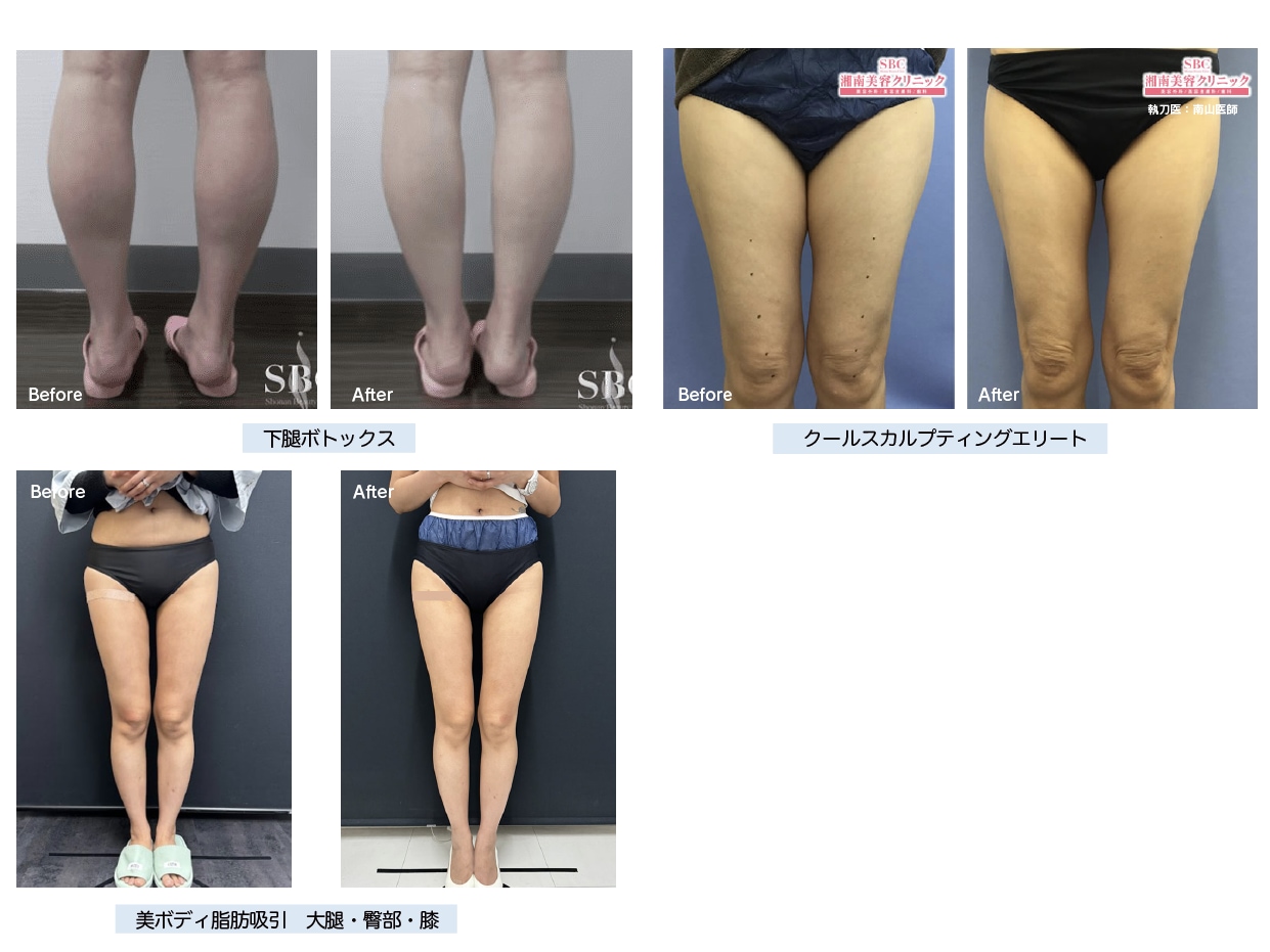 医療痩身・ダイエット】大阪で確実に痩せたいなら京橋院にお任せ 